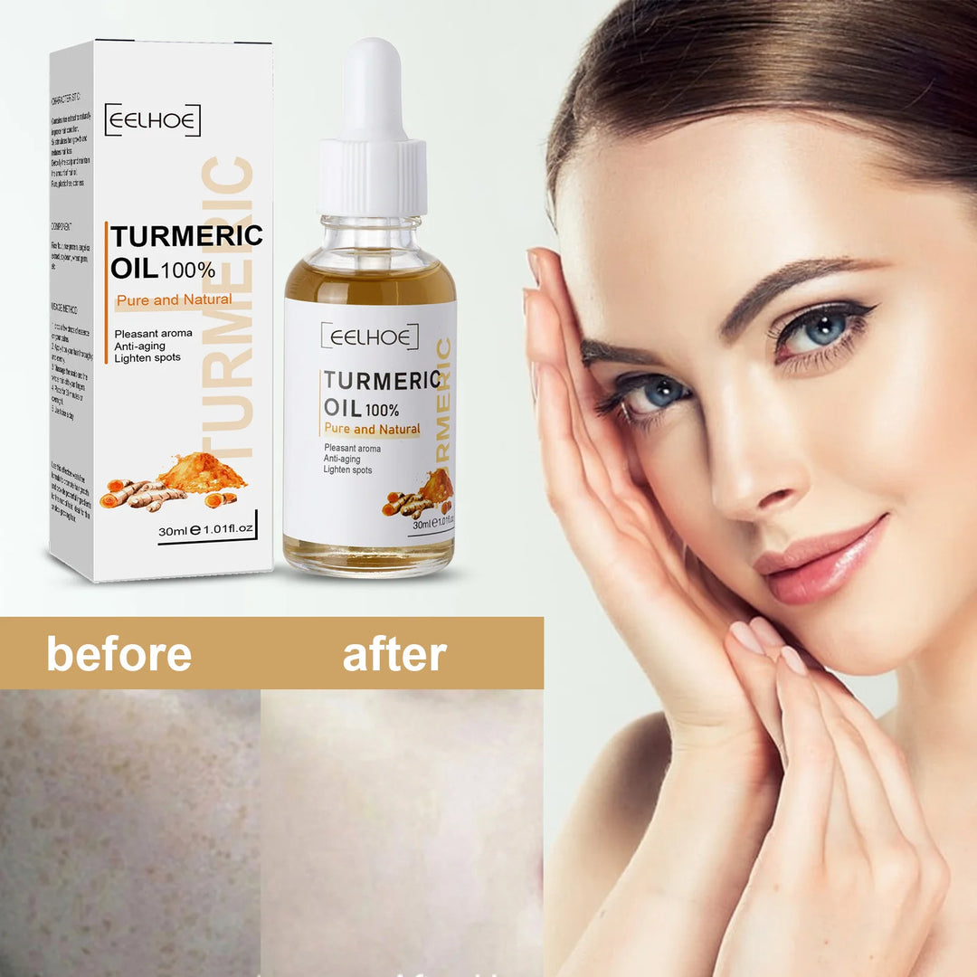 EmpowerEase Turmeric Dark Spot Correction Serum – Brighten Skin Tone, Fade Dark Spots & Hydrate