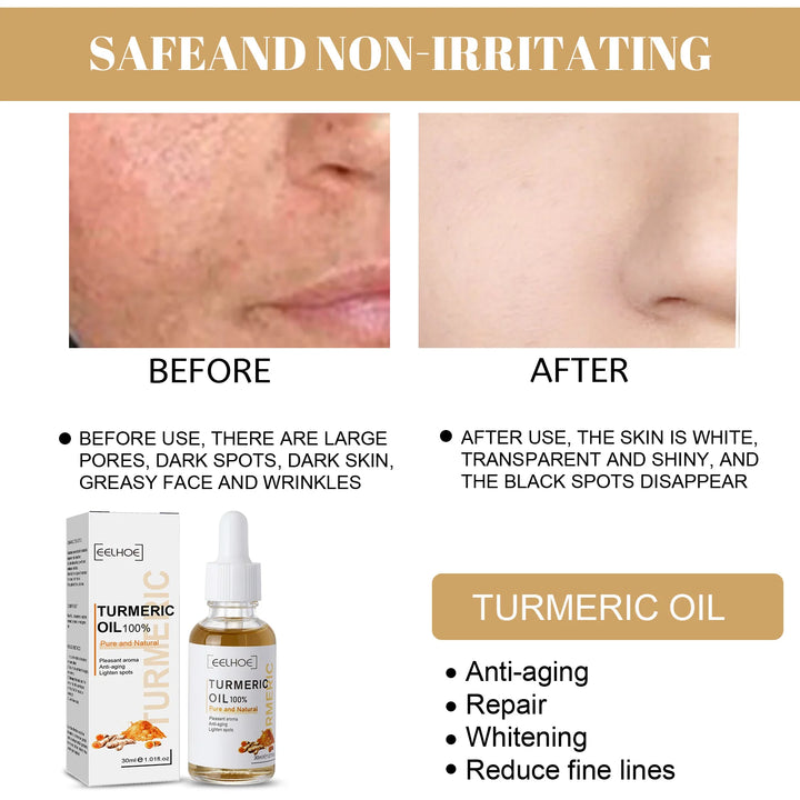 EmpowerEase Turmeric Dark Spot Correction Serum – Brighten Skin Tone, Fade Dark Spots & Hydrate