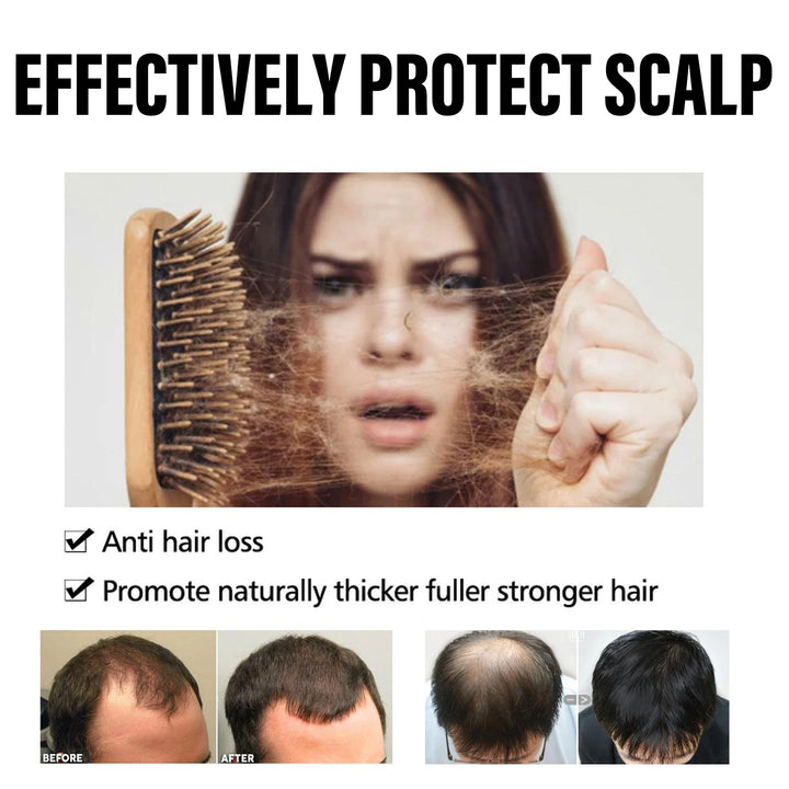 HOEGOA Hair Regrowth Capsules – Morocco Essential Oil Scalp Treatment (30pcs)