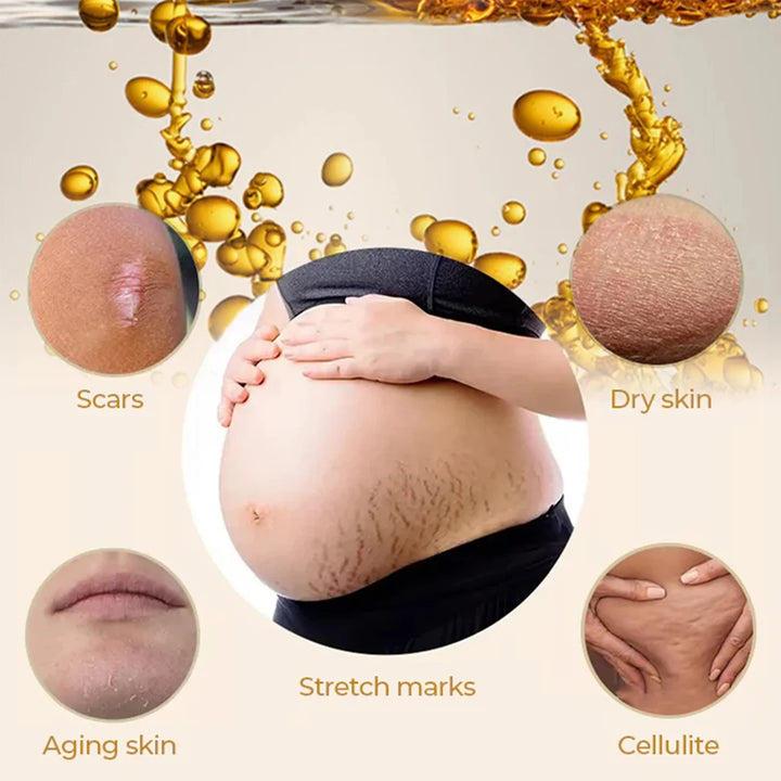 EELHOE Olive Smoothing Oil – Stretch Mark & Scar Repair Massage Oil