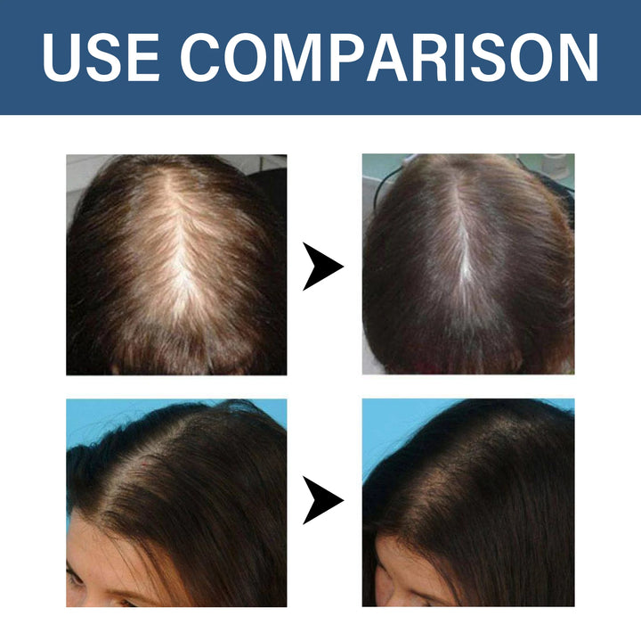 Hoegoa Moroccan Hair Regrowth Capsules – Nourishing Leave-In Treatment for Hair Thinning & Scalp Health (30pcs)