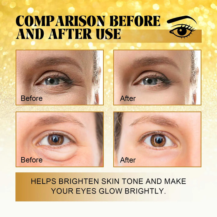 EmpowerEase 24K Gold Anti-Wrinkle Eye Mask – Brighten, Lift & Hydrate