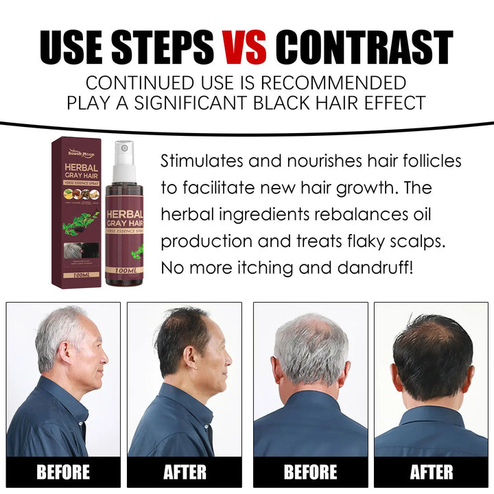 Southmoon Hair Darkening Herbal Spray – 100ml | White-to-Black Natural Color Restorer, Anti-Grey & Hair Loss Serum