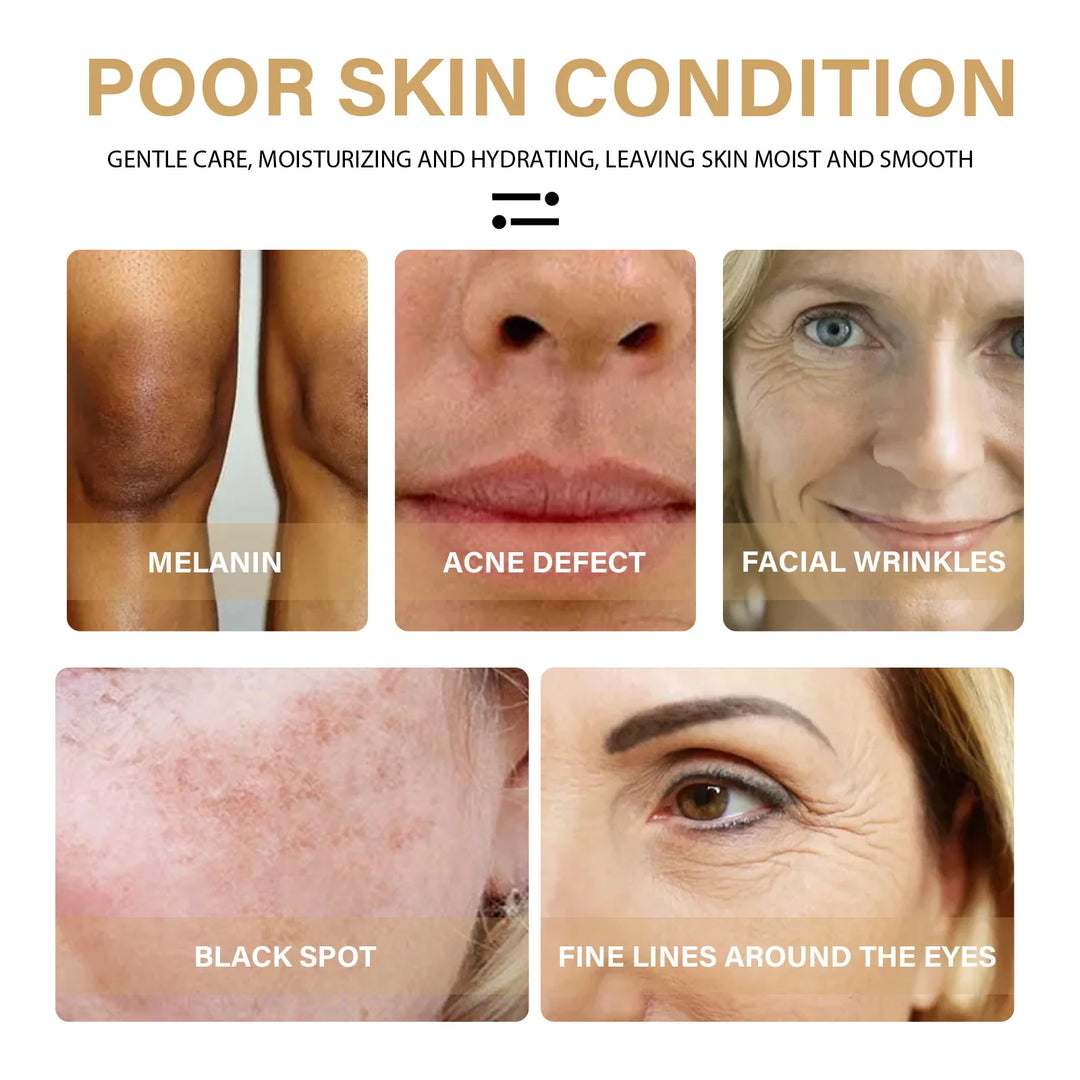 EmpowerEase Turmeric Dark Spot Correction Serum – Brighten Skin Tone, Fade Dark Spots & Hydrate
