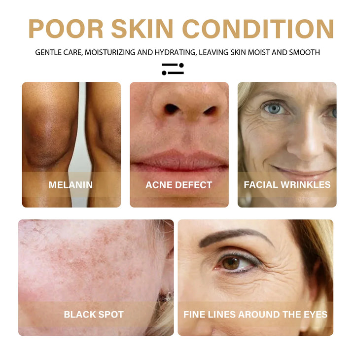 EmpowerEase Turmeric Dark Spot Correction Serum – Brighten Skin Tone, Fade Dark Spots & Hydrate