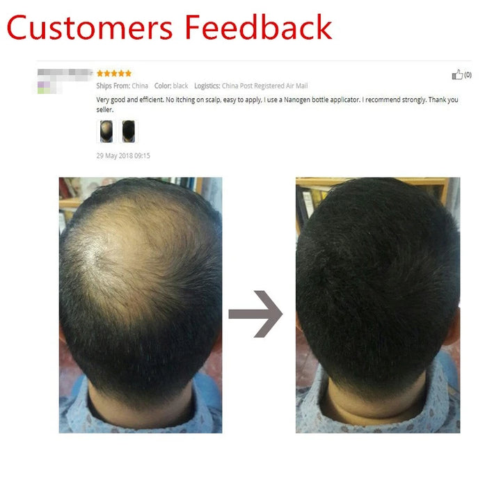 Sevich Hair Building Fibers Refill – 100g | Instant Thicker, Fuller Hair | 10 Colors | Keratin Hair Loss & Thinning Solution
