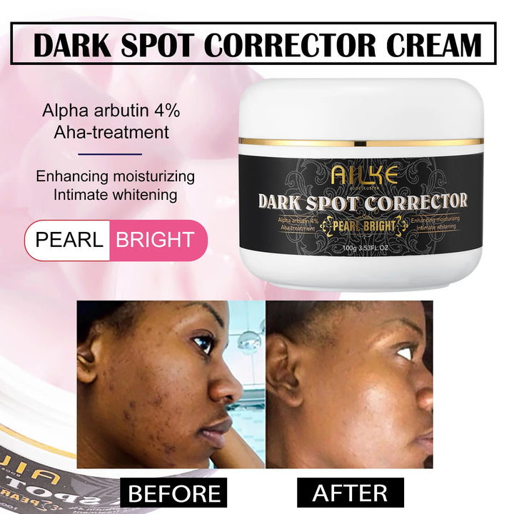 Radiance Renewal Dark Spot Corrector – Face & Body Brightening Cream