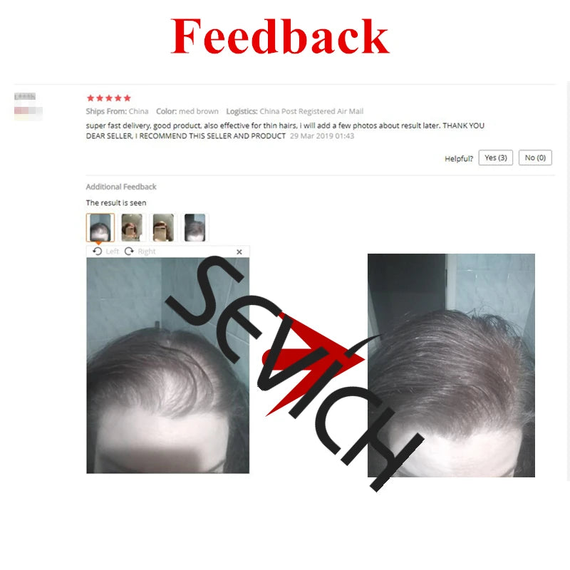 Sevich Hair Building Fibers Refill – 100g | Instant Thicker, Fuller Hair | 10 Colors | Keratin Hair Loss & Thinning Solution