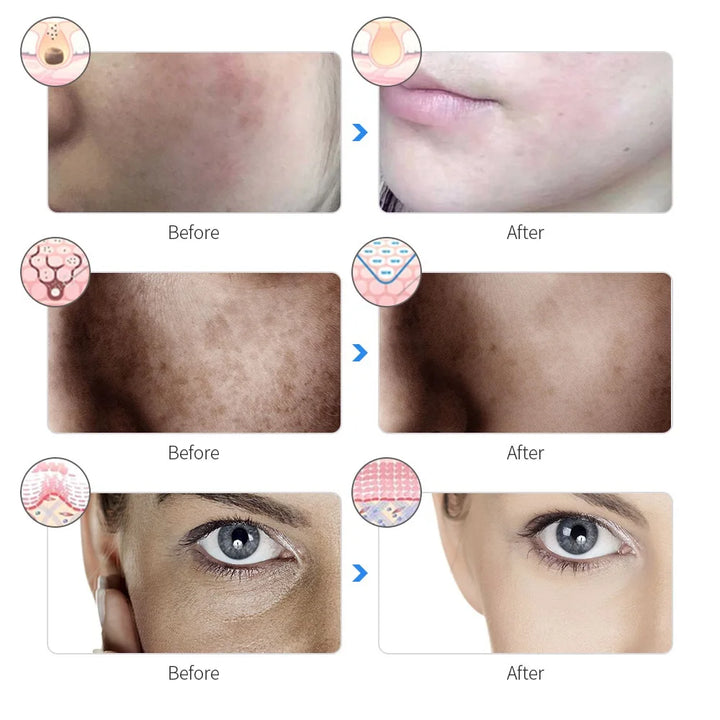 LumaGlow 7-Color LED Facial Therapy Mask