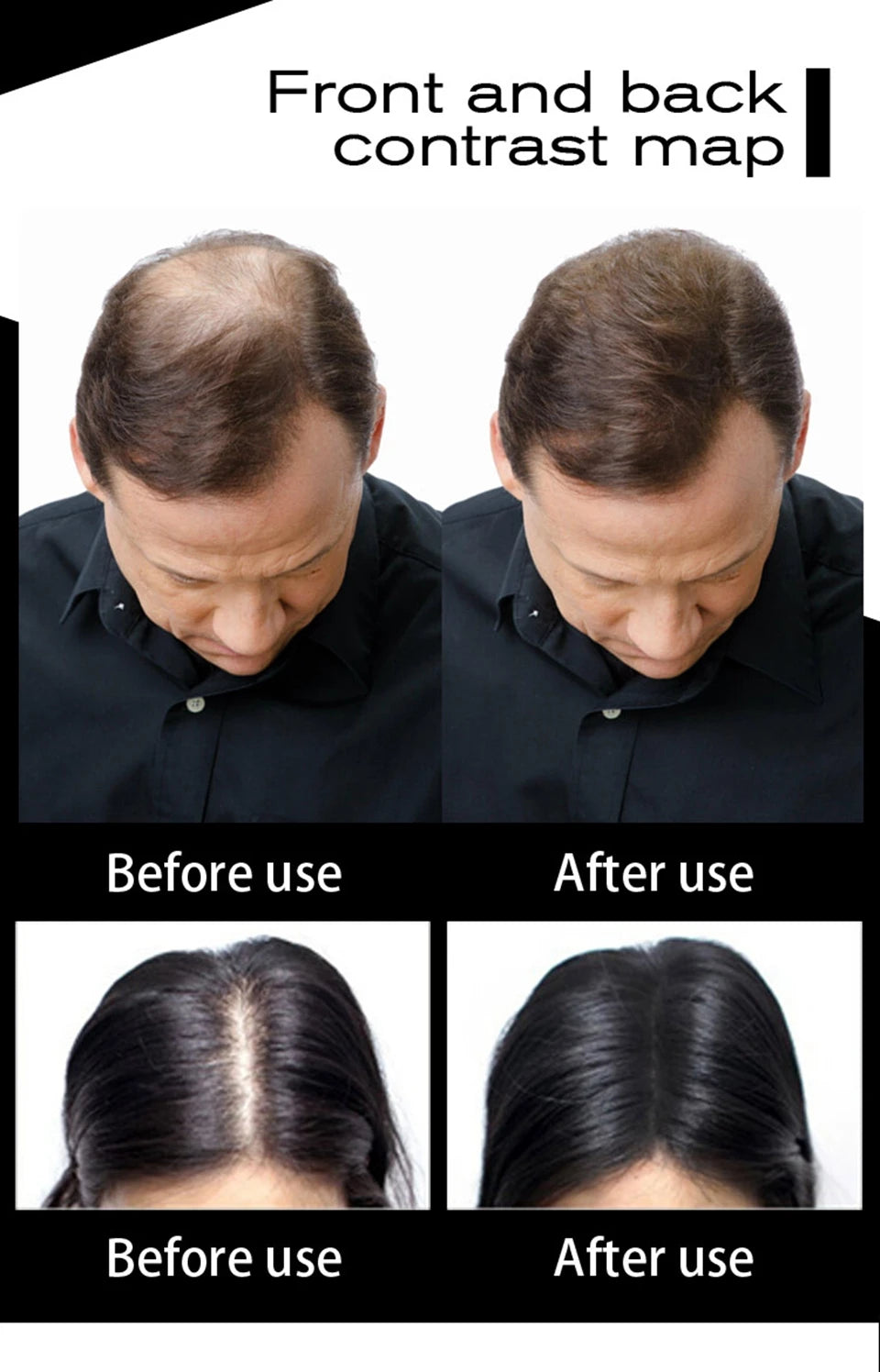 Sevich Hair Building Fiber – 100g Refill (10 Shades)