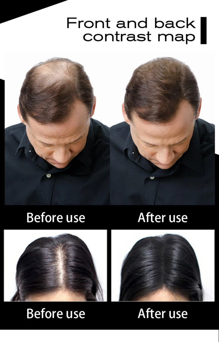 Sevich Hair Building Fibers Refill – 100g | Instant Thicker, Fuller Hair | 10 Colors | Keratin Hair Loss & Thinning Solution