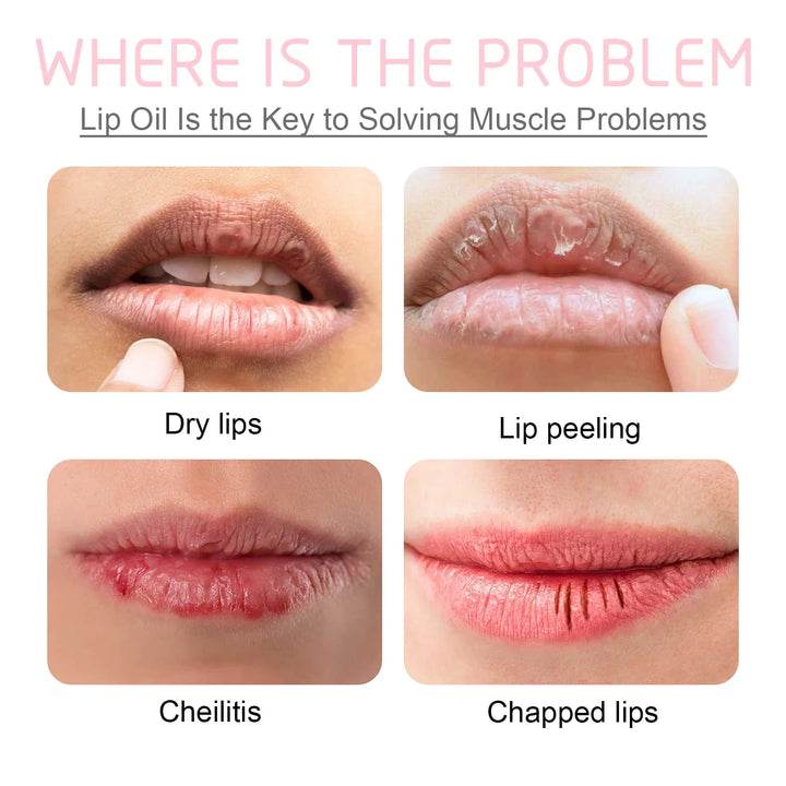 Glow Renewal Bubble Lip Balm Set – 3-Piece Exfoliating & Brightening Treatment