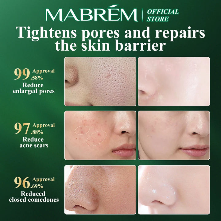MABREM Pomegranate Pore-Refining Serum – Plant-Based Essence for Smooth, Bright, and Hydrated Skin (10ml)