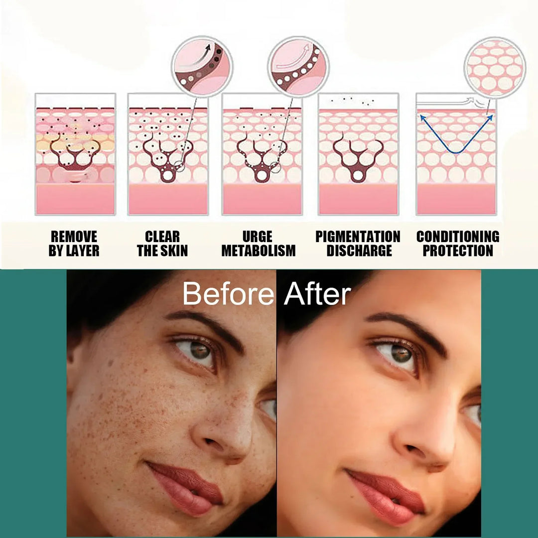 EELHOE Niacinamide Brightening Cream – Fade Melasma, Dark Spots & Fine Lines