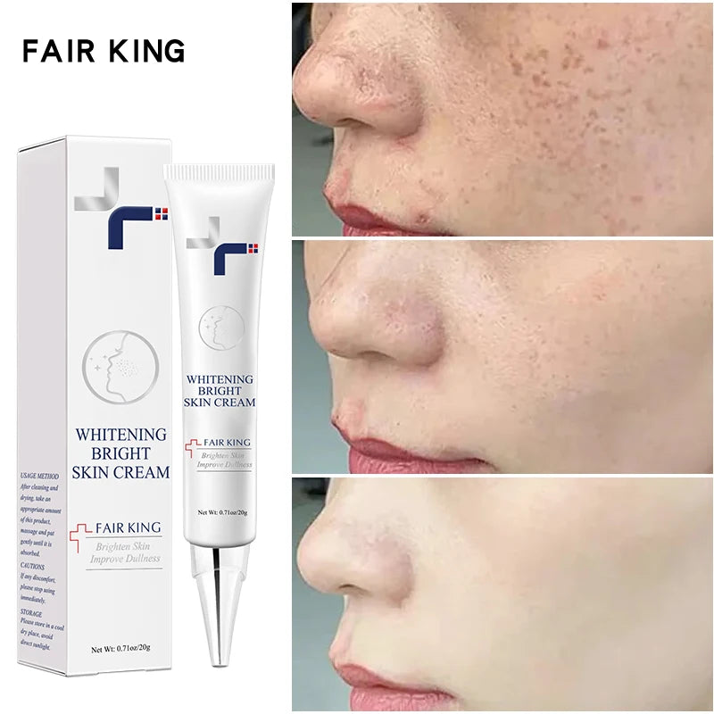 FAIR KING Dark Spot Corrector & Whitening Cream