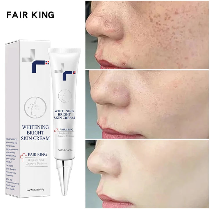 FAIR KING Dark Spot Corrector & Whitening Cream