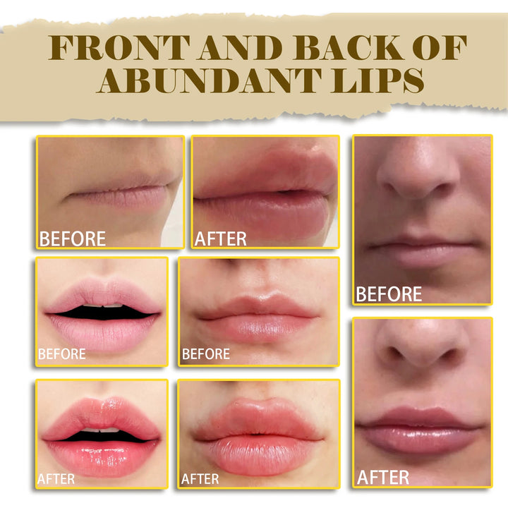 Long-Lasting Lip Plumping Essential Oil – Moisturizing Lip Balm with Coconut Oil, Vitamin E & Squalane – Smooths Fine Lines & Boosts Lip Elasticity (10ml)