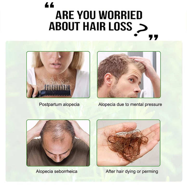 Goiple Rosemary Mint Hair Growth Serum – Essential Oil Treatment for Dry, Damaged & Thinning Hair