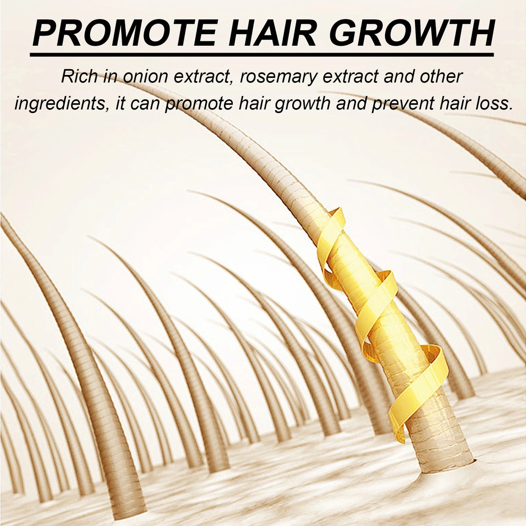 Biotin & Onion Extract Shampoo – Hair Growth & Anti-Hair Loss Formula (200ml)