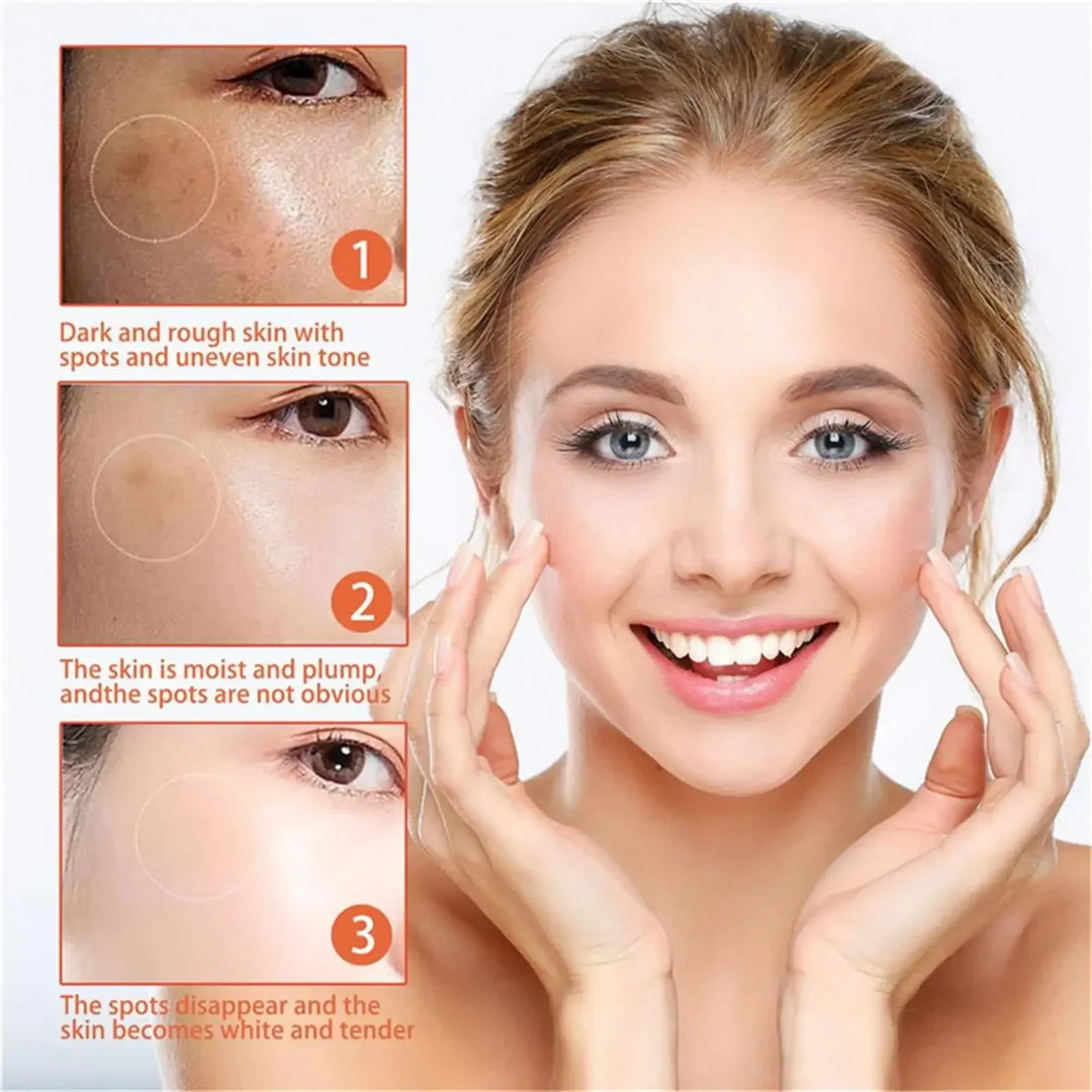 EELHOE Niacinamide Brightening Cream – Fade Melasma, Dark Spots & Fine Lines