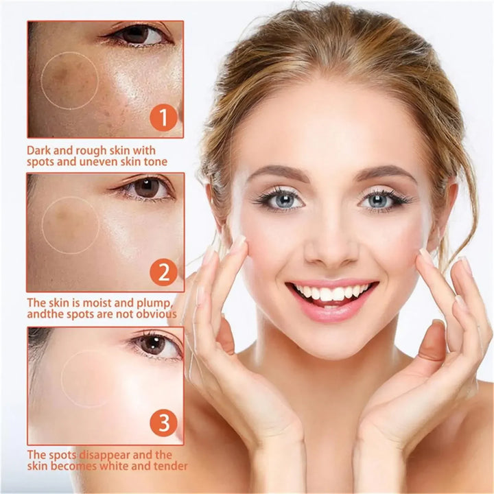 EELHOE Niacinamide Brightening Cream – Fade Melasma, Dark Spots & Fine Lines