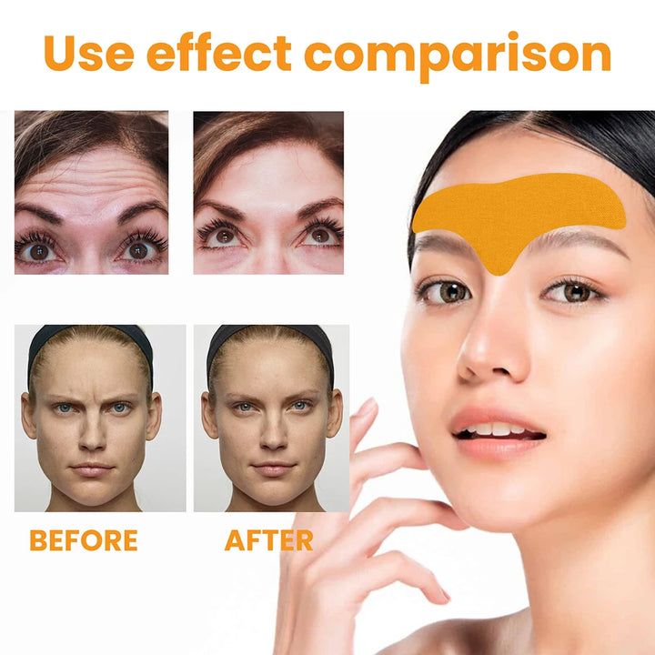 EmpowerEase Collagen Forehead Wrinkle Patches – Smoothing, Lifting & Anti-Aging Care (10-Pack)