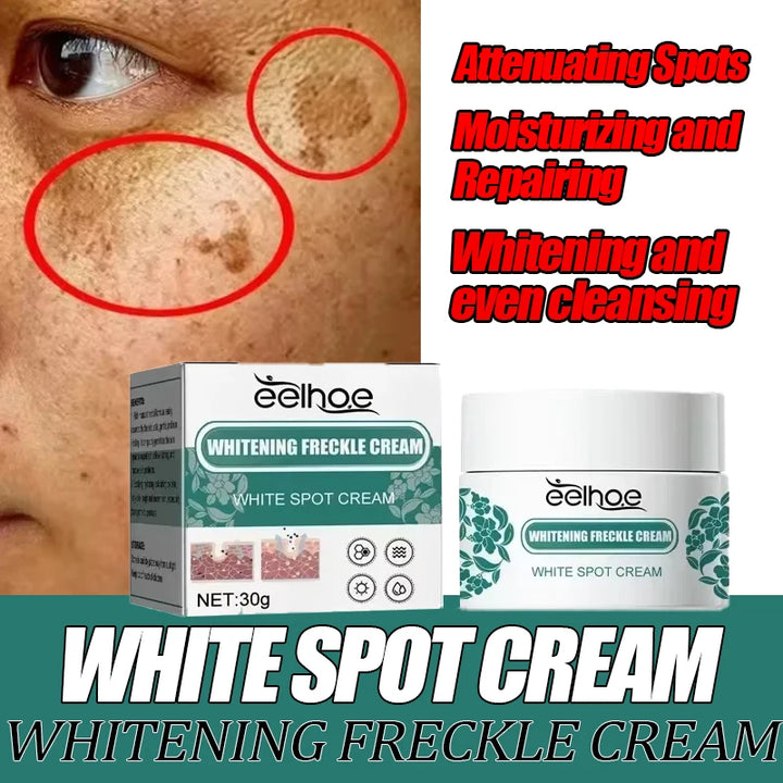 EELHOE Niacinamide Melasma Brightening Cream – Fade Freckles, Dark Spots & Uneven Tone