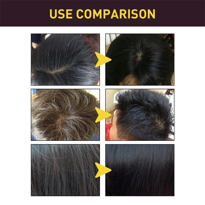 Eelhoe 3-in-1 Black Hair Coloring Shampoo – 2pcs Natural Herbal Polygonum Shampoo for Gray Coverage & Scalp Care (100ml Each)