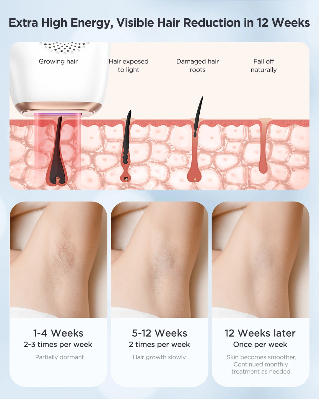 INNZA IceCool IPL Hair Removal Device – 9 Levels for Painless, Permanent Results