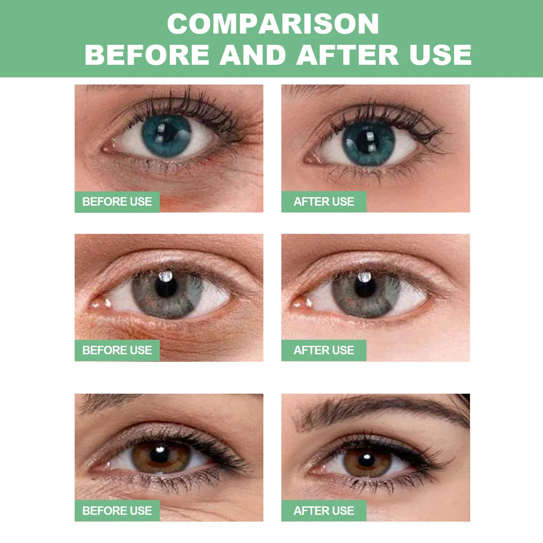 Aloe Vera Collagen Eye Mask – 60 Pieces for Dark Circles, Puffiness & Fine Lines