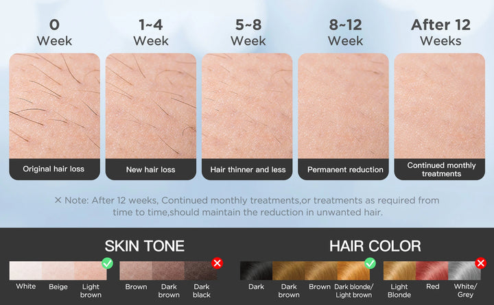 INNZA IceCool IPL Hair Removal Device – 9 Levels for Painless, Permanent Results