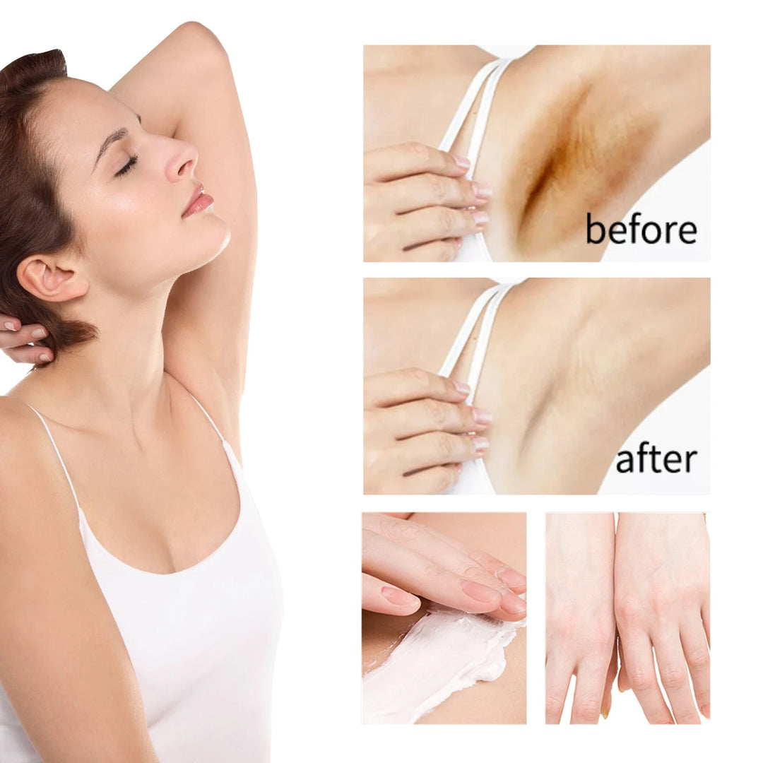 EELHOE Whitening Cream – Underarm, Legs, Knees, Elbows, Inner Thighs & Joints