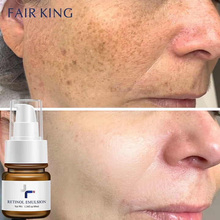 EmpowerEase Retinol Renewal Face Lotion