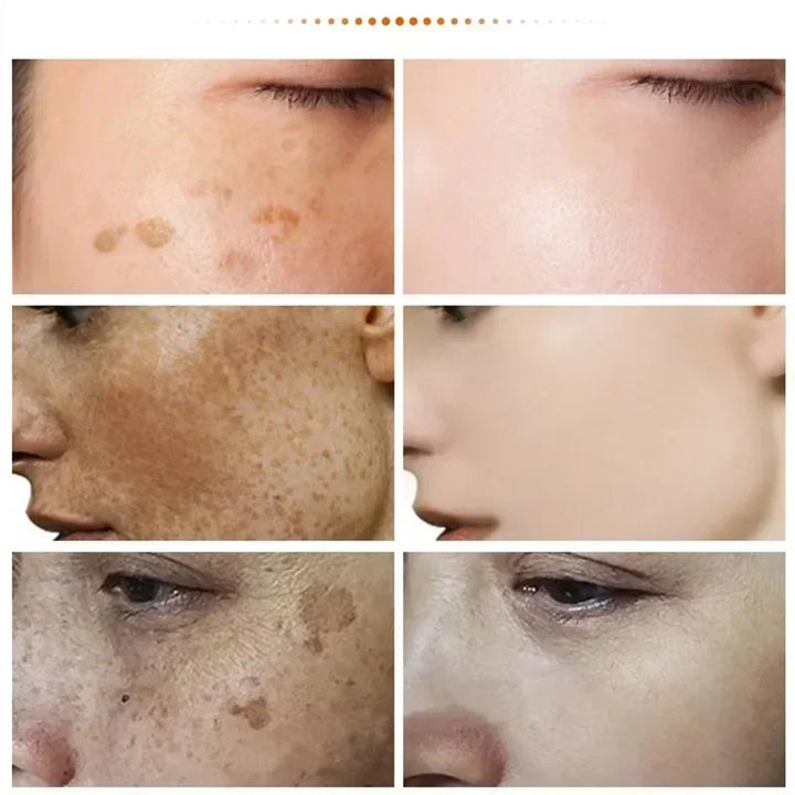 EELHOE Niacinamide Brightening Cream – Fade Melasma, Dark Spots & Fine Lines