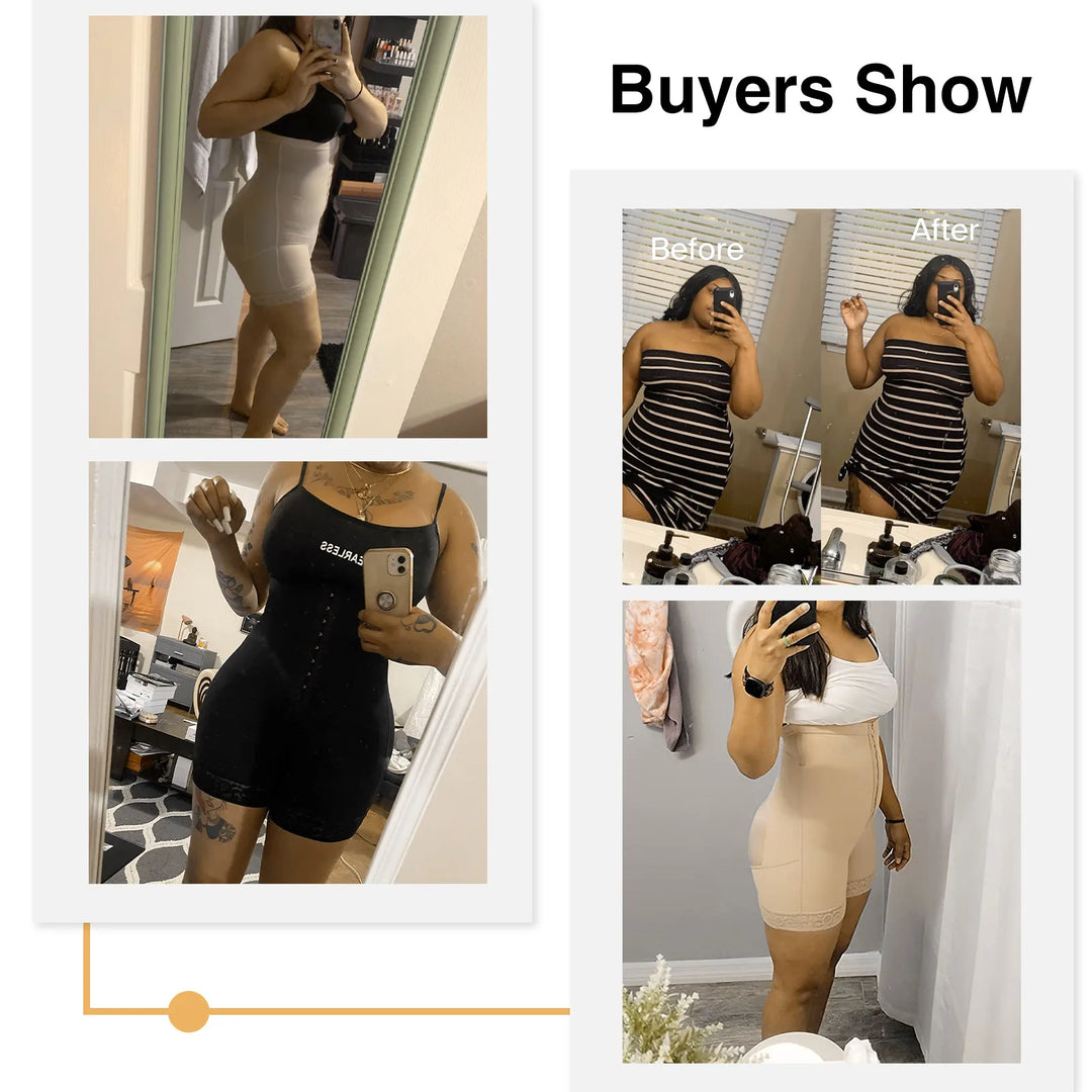 3-in-1 Lace Butt Lifter Corset – High-Waist Tummy Control Shapewear