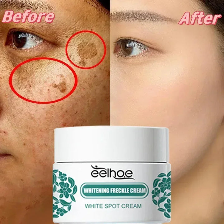 EELHOE Niacinamide Brightening Cream – Fade Melasma, Dark Spots & Fine Lines