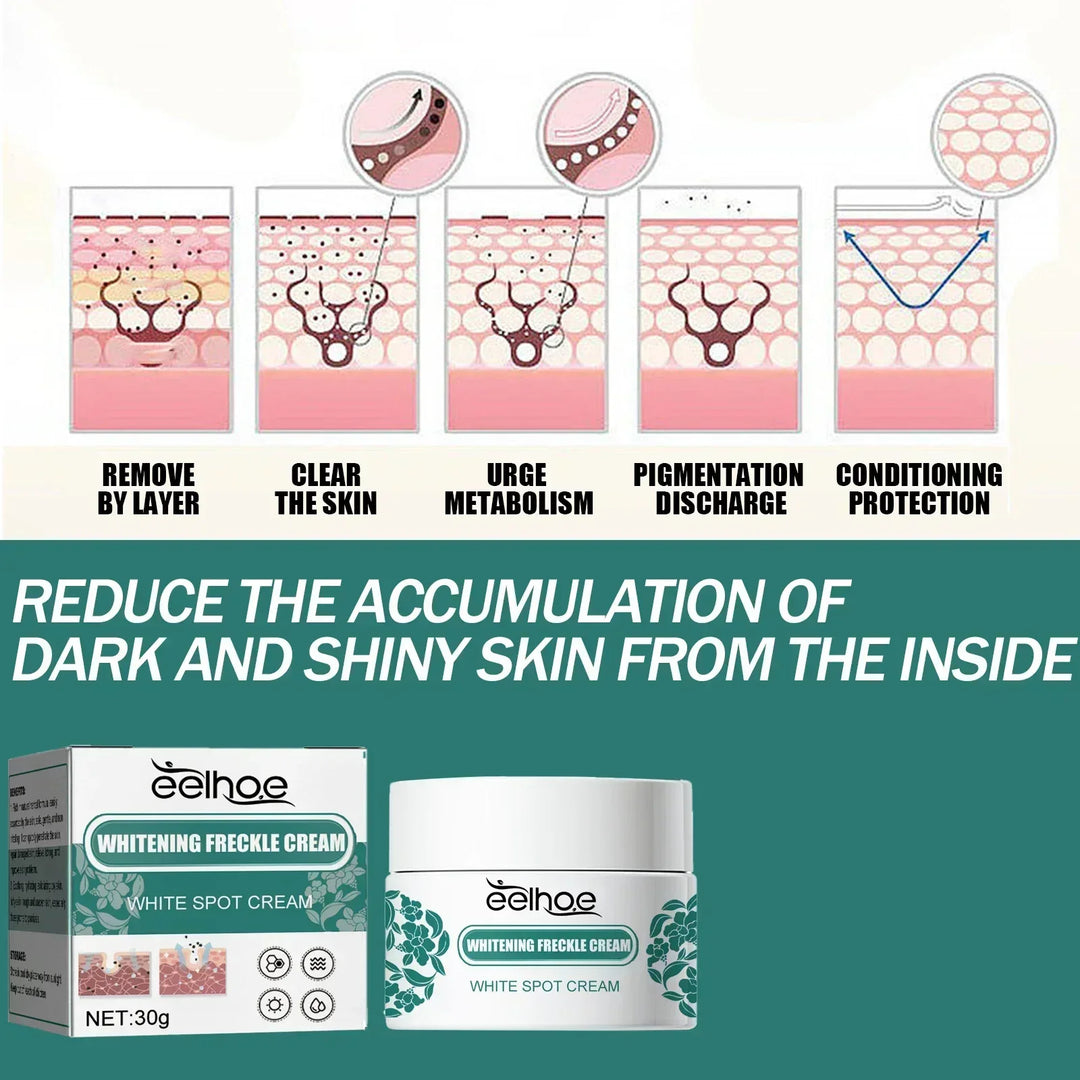 EELHOE Niacinamide Melasma Brightening Cream – Fade Freckles, Dark Spots & Uneven Tone