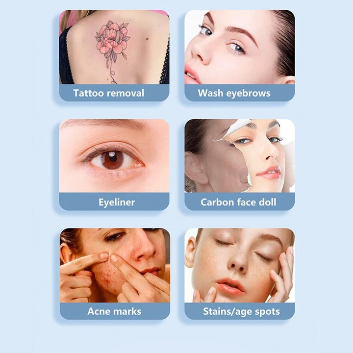 Radiance Renew Laser Precision System