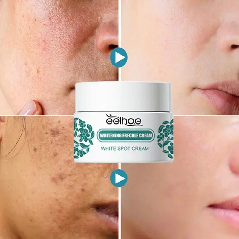 EELHOE Niacinamide Brightening Cream – Fade Melasma, Dark Spots & Fine Lines