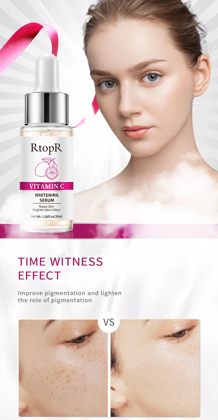 RtopR Vitamin C Whitening Serum (30ml)