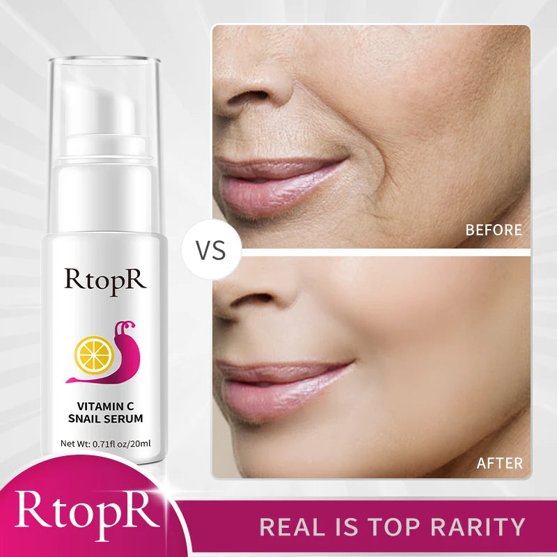 Radiant Renewal Serum – Vitamin C & Snail Essence Firming Elixir