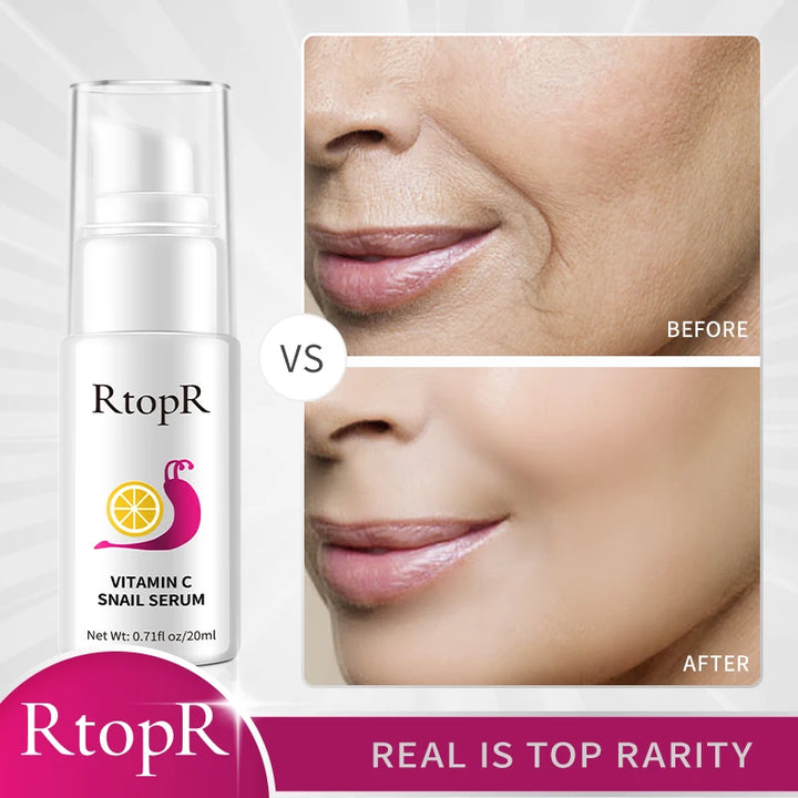 Radiant Renewal Serum – Vitamin C & Snail Essence Firming Elixir