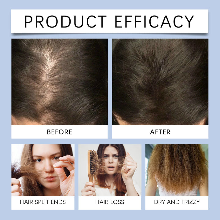 Rosemary Biotin Hair Revival Oil – Strengthening & Volumizing Treatment with Jojoba & Castor Oils
