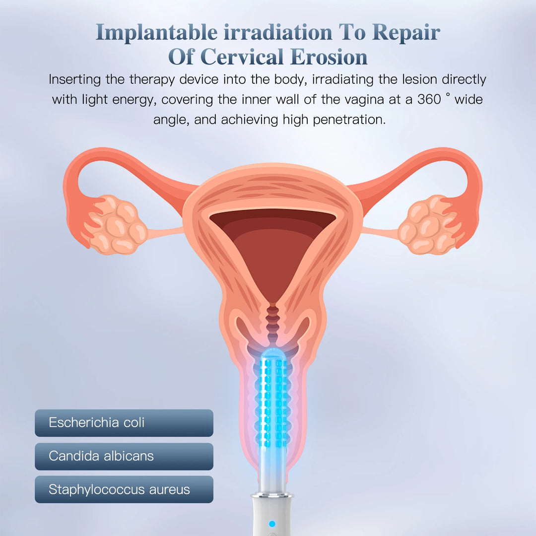 KTS Vaginal Vibrator – Wireless Vaginal Massager with Red Light Therapy | Vaginal Tightening, Vaginitis Relief & Pelvic Health Device