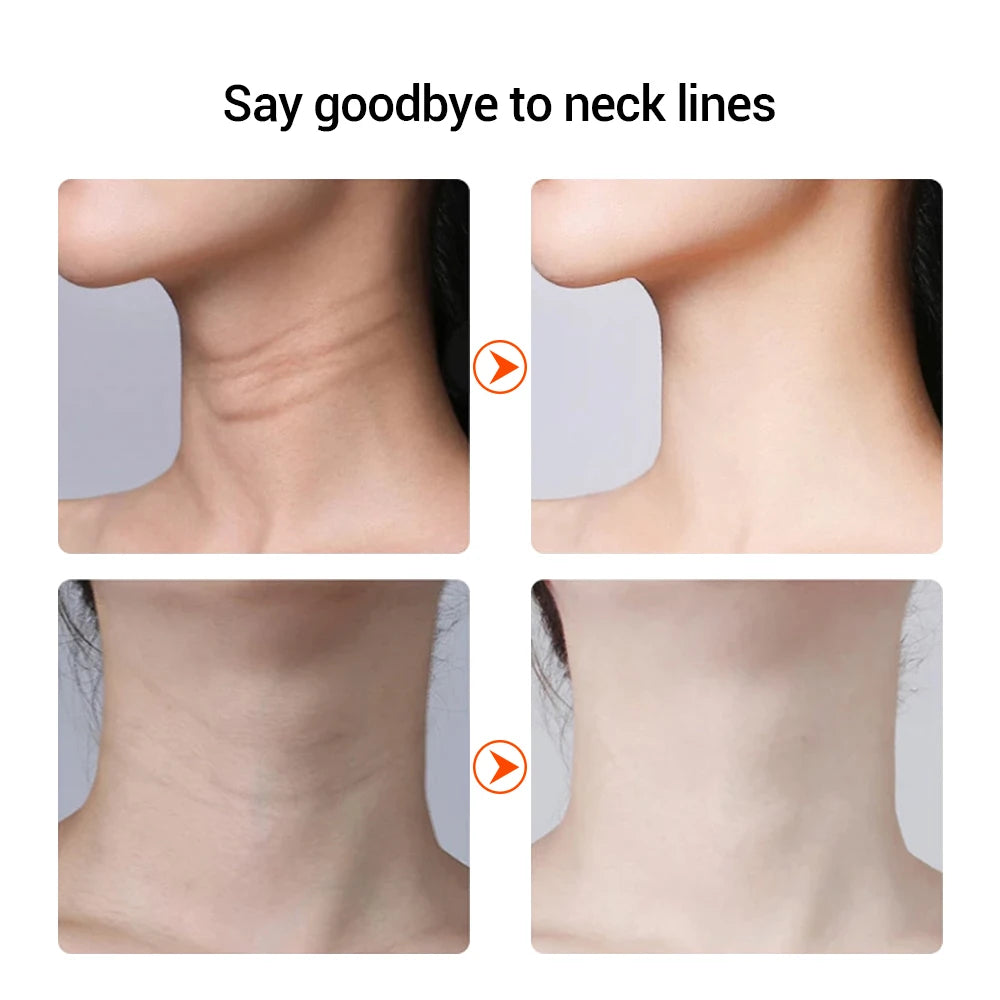Moajaza EMS Neck & Face Lifting Device