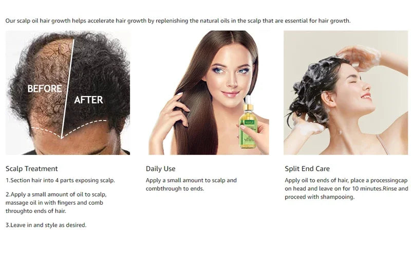 Goiple Rosemary Mint Hair Growth Serum – Essential Oil Treatment for Dry, Damaged & Thinning Hair