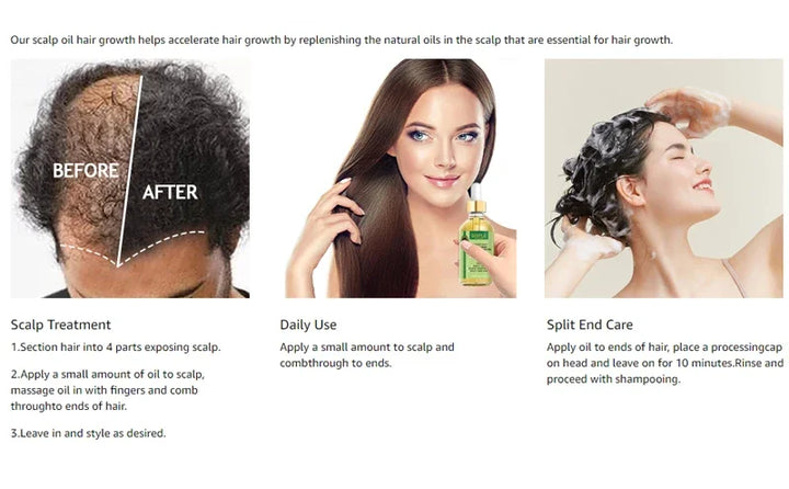 Goiple Rosemary Mint Hair Growth Serum – Essential Oil Treatment for Dry, Damaged & Thinning Hair