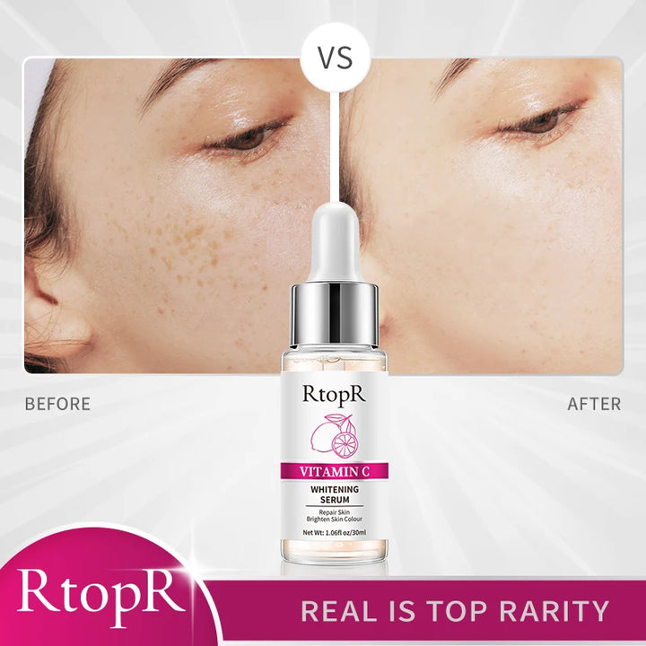 RtopR Vitamin C Whitening Serum (30ml)