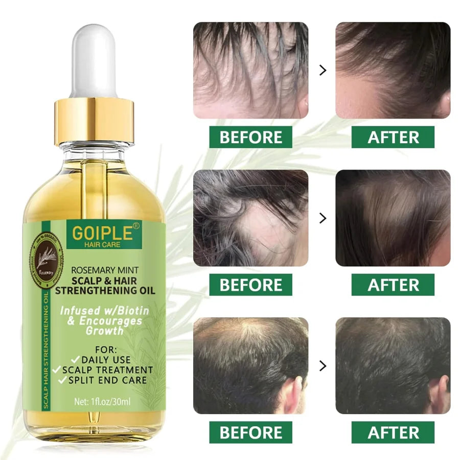 Goiple Rosemary Mint Hair Growth Serum – Essential Oil Treatment for Dry, Damaged & Thinning Hair