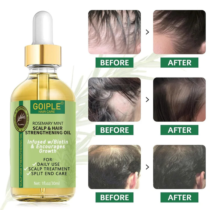Goiple Rosemary Mint Hair Growth Serum – Essential Oil Treatment for Dry, Damaged & Thinning Hair